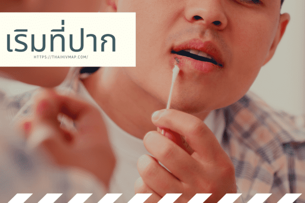 เริมที่ปาก.png