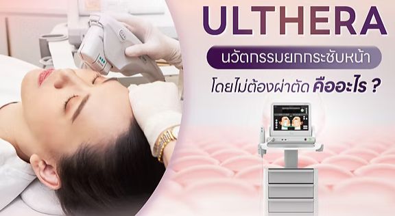 ulthera87d5345e97cdb045.jpg.jpg