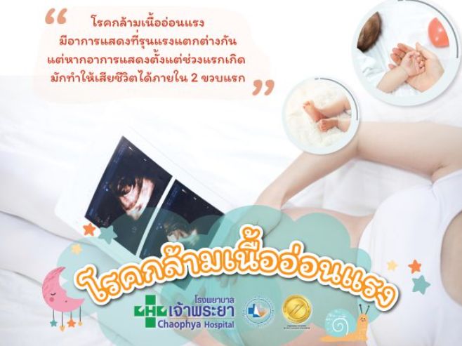 โรคกล้ามเนื้ออ่อนแรง เช็กสัญญาณเตือนก่อนลุกลาม