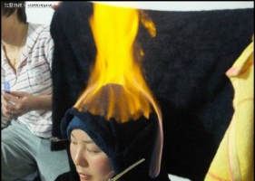 A:ภาพไฟบำบัดในจีน จุดไฟบนตัวคนไข้รักษาสารพัดโรค